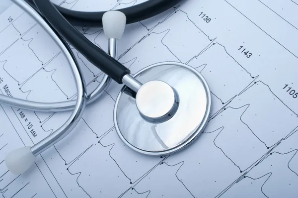 Stetoscope ve EKG closeup — Stok fotoğraf