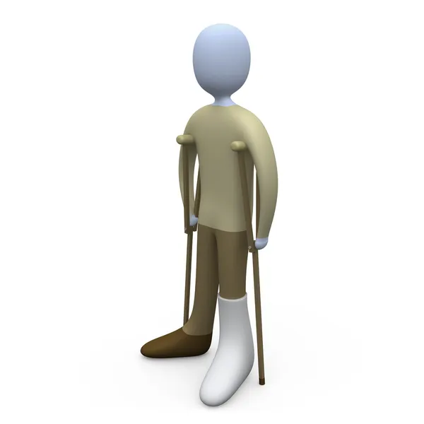 Persona con el pie roto — Foto de Stock