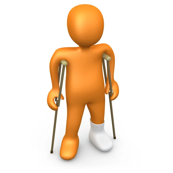 Persona con el pie roto — Foto de Stock