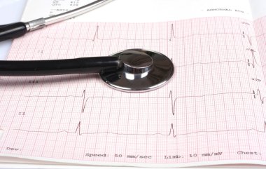 Stethoscope on ecg graph clipart