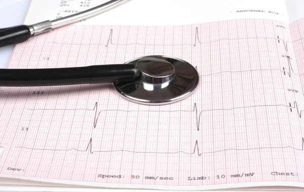 心電図グラフ上の聴診器 — ストック写真