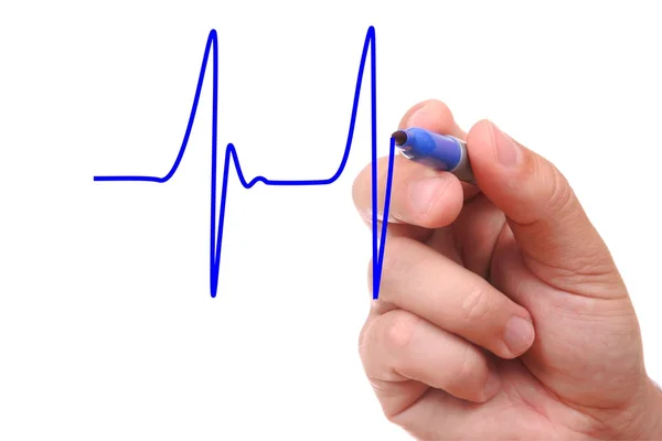 Kézi rajz EKG grafikon — Stock Fotó