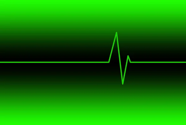 心脏电子心率监视器 — 图库照片