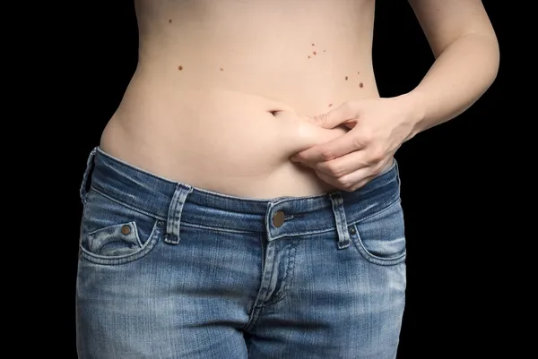 Girl measuring fat on her stomach — Stock Photo, Image