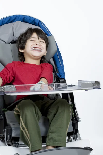 Menino deficiente de três anos — Fotografia de Stock