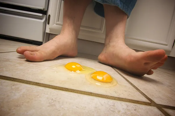 stock image Eggs on the Floor at Mans Feet