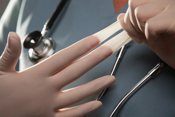 Доктор снимает хирургические перчатки — стоковое фото