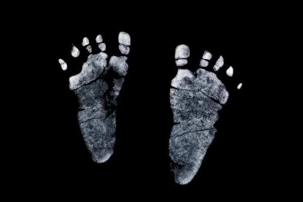 Newborn's Feet Print — Stock Photo, Image