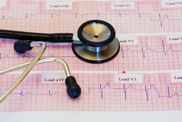 EKG z pracownia — Zdjęcie stockowe