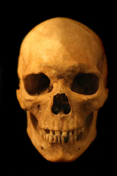 人类头骨 — 图库照片
