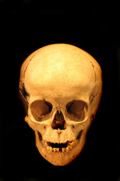 人类头骨 — 图库照片