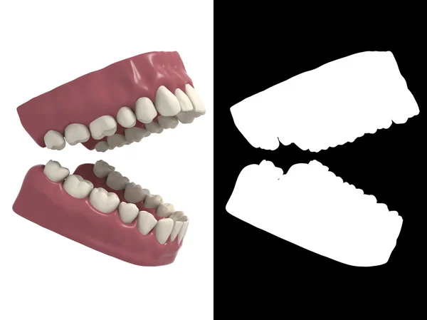 牙科假牙 — 图库照片