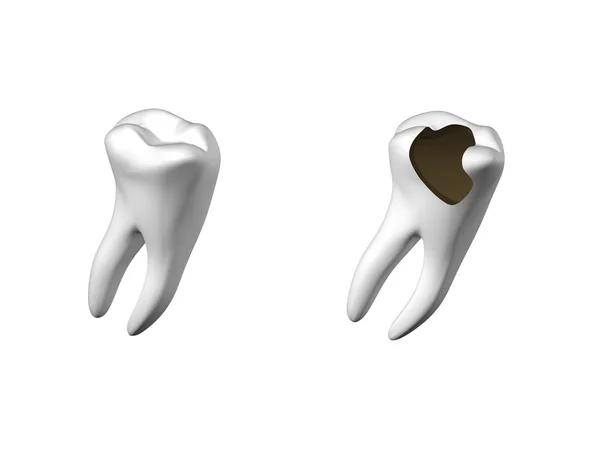 Dente umano — Foto Stock