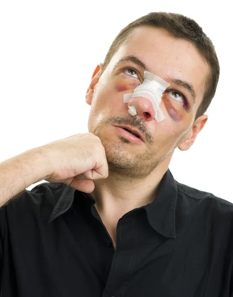 Broken nose post operation — Stock Photo, Image