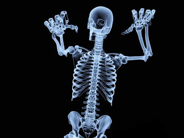 Xray skelet — Stockfoto