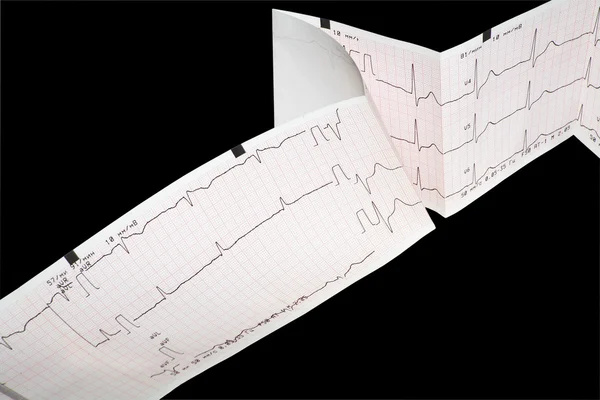 stock image ECG Graph