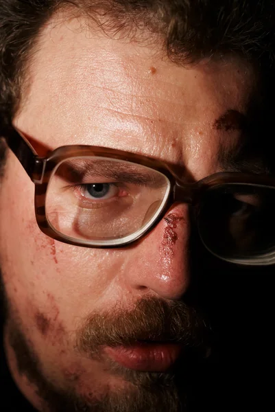 Homem em vidro com pequenas feridas no rosto — Fotografia de Stock