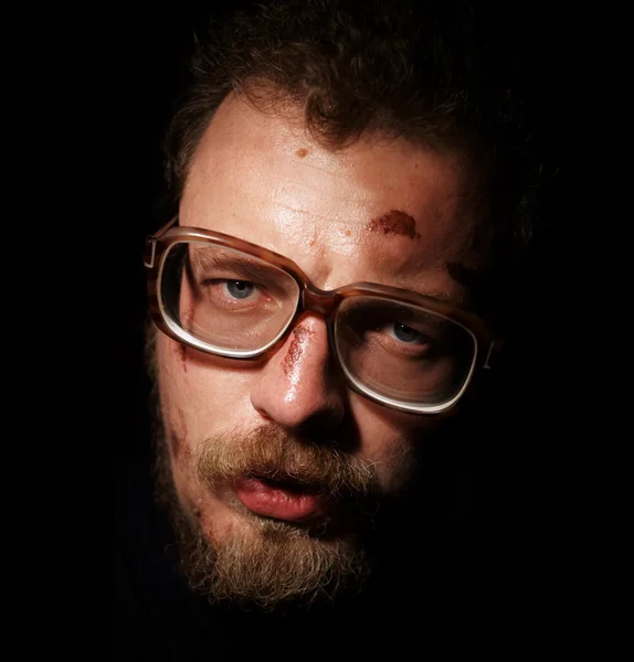 stock image Man on glass with small sores on face