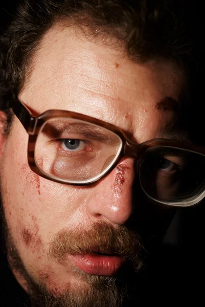Człowiek na szkle z małej rany na twarzy Obrazek Stockowy