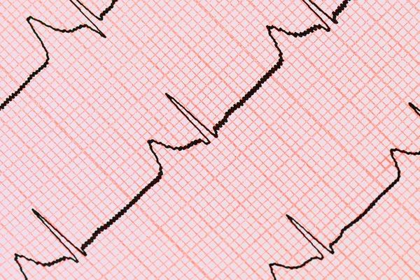 stock image ECG graph