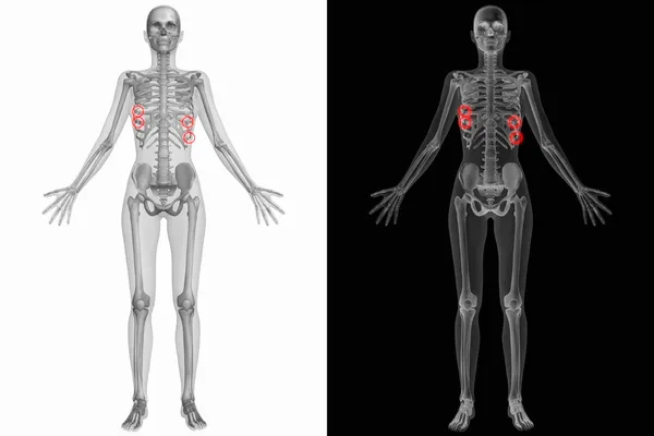 Anatomia humana costelas quebradas — Fotografia de Stock