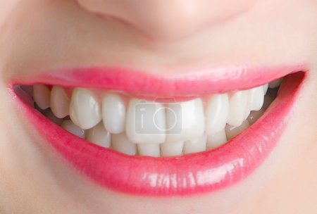 Belles lèvres et dents 